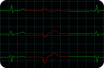 Product_Chroma2_Features_3channel