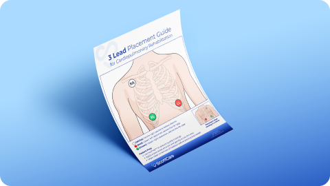 https://www.scottcare.com/wp-content/uploads/2025/12/PD-400536-Rev-C_Rehab-lead-placement.pdf._Card.webp